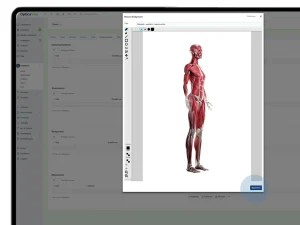 Screenshot von Optica Viva: Geöffneter Bodychart-Editor mit anatomischer Muskelansicht (weiblich, lateral rechts) zur visuellen Befunddokumentation in der Patientenakte.